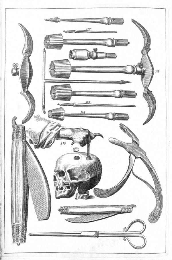 Surgery , Trepanation