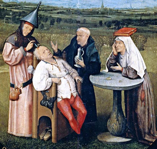 Surgery , Trepanation